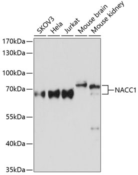 NACC1 Polyclonal Antibody