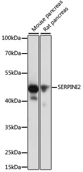 SERPINI2 Polyclonal Antibody