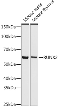 RUNX2 Monoclonal Antibody [7O7J4]