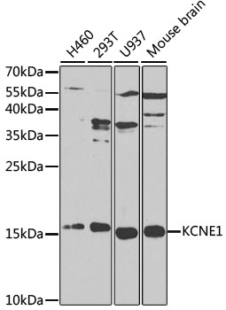 KCNE1 Polyclonal Antibody