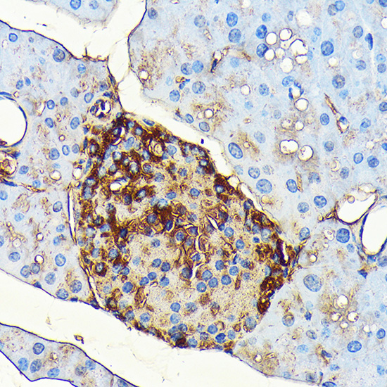 Glucagon Monoclonal Antibody