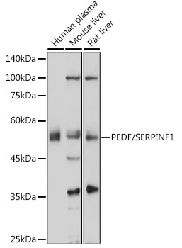 PEDF/SERPINF1 Polyclonal Antibody