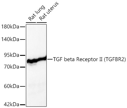 TGF beta Receptor II Polyclonal Antibody