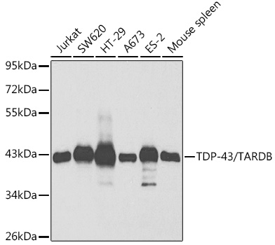 TDP-43/TARDBP Polyclonal Antibody