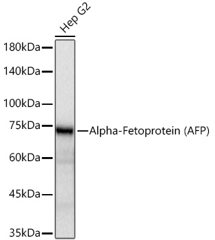 Alpha-Fetoprotein (AFP) Monoclonal Antibody