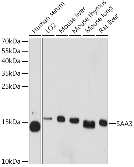 SAA3 Polyclonal Antibody