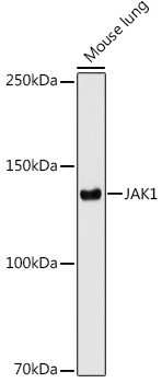 JAK1 Monoclonal Antibody [7Q1B2]