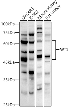 WT1 Polyclonal Antibody