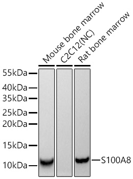 S100A8 Monoclonal Antibody [5Z7U8]