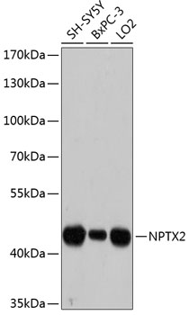NPTX2 Polyclonal Antibody