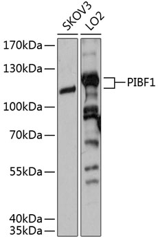 PIBF1 Polyclonal Antibody
