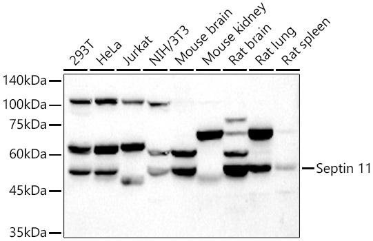 Septin 11 Polyclonal Antibody