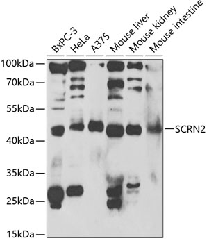SCRN2 Polyclonal Antibody