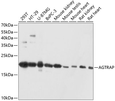 AGTRAP Polyclonal Antibody&nbsp;<img src="images/icon_newarrival.gif" alt="new" border="0">