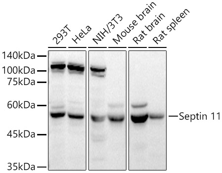 Septin 11 Polyclonal Antibody