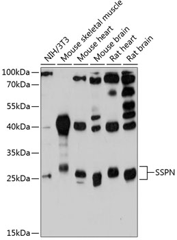 SSPN Polyclonal Antibody