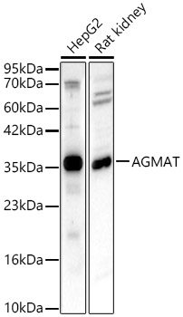 AGMAT Polyclonal Antibody&nbsp;<img src="images/icon_newarrival.gif" alt="new" border="0">