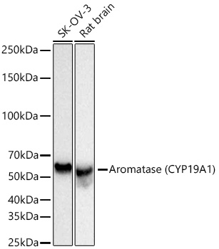 Aromatase (CYP19A1) Monoclonal Antibody [5C5N7]
