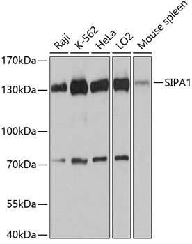 SIPA1 Polyclonal Antibody