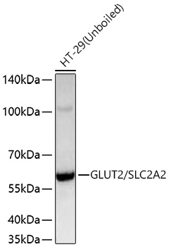 GLUT2/SLC2A2 Monoclonal Antibody [2V2U2]