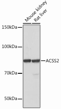 ACSS2 Monoclonal Antibody&nbsp;<img src="images/icon_newarrival.gif" alt="new" border="0">