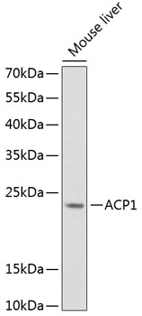 ACP1 Polyclonal Antibody&nbsp;<img src="images/icon_newarrival.gif" alt="new" border="0">