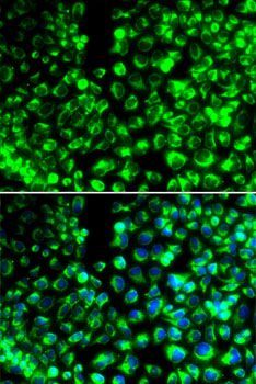 CALU Polyclonal Antibody