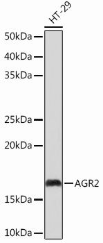 AGR2 Monoclonal Antibody [6M5B1]&nbsp;<img src="images/icon_newarrival.gif" alt="new" border="0">