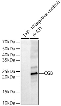 CGB Polyclonal Antibody