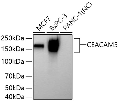 CEACAM5 Polyclonal Antibody