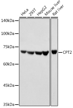 CPT2 Polyclonal Antibody