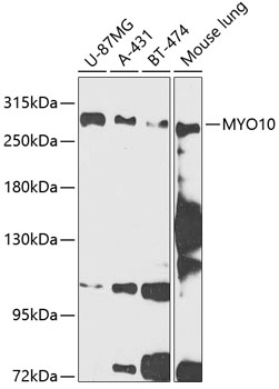 MYO10 Polyclonal Antibody