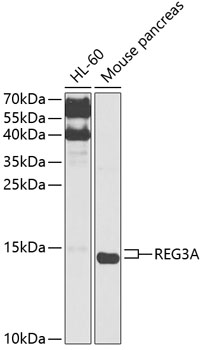 REG3A Polyclonal Antibody