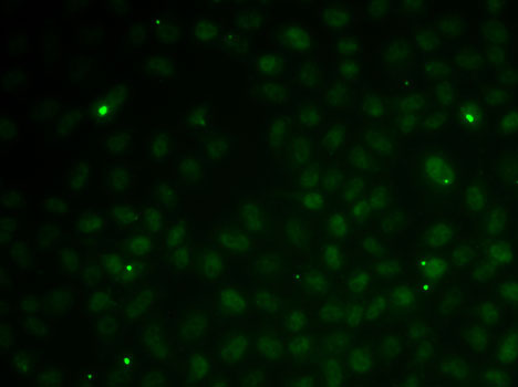 RAD51C Polyclonal Antibody