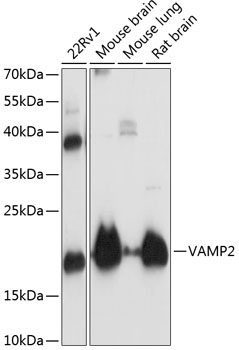 VAMP2 Polyclonal Antibody