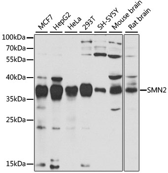 SMN2 Polyclonal Antibody