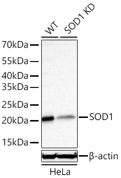 SOD1 Monoclonal Antibody [2K8W4]