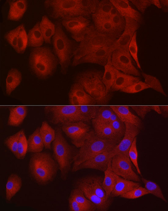 WISP2 Polyclonal Antibody