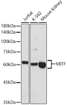 MITF Polyclonal Antibody