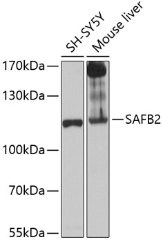 SAFB2 Polyclonal Antibody