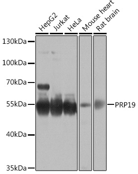 PRP19 Polyclonal Antibody