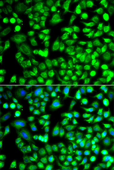 ALKBH4 Polyclonal Antibody
