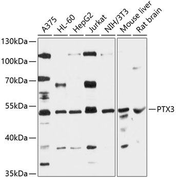 PTX3 Polyclonal Antibody