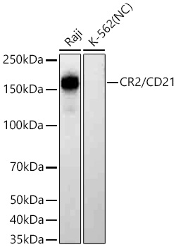 CR2/CD21 Monoclonal Antibody [1T2Z9]