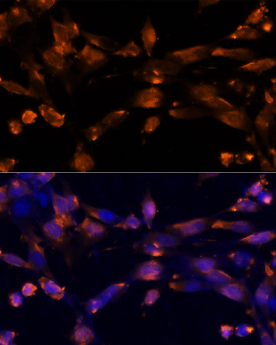 AREG Polyclonal Antibody