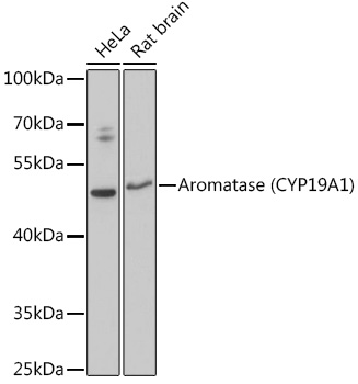 Aromatase (CYP19A1) Polyclonal Antibody