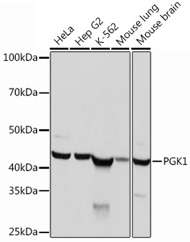 PGK1 Monoclonal Antibody [4B3Q3]