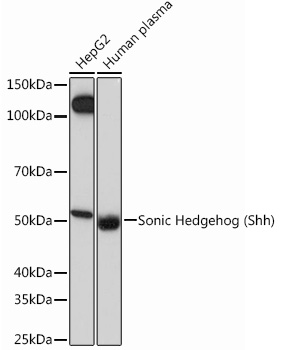Sonic Hedgehog (Shh) Monoclonal Antibody [8T4D3]