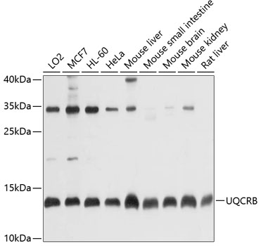 UQCRB Polyclonal Antibody