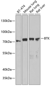 BTK Polyclonal Antibody